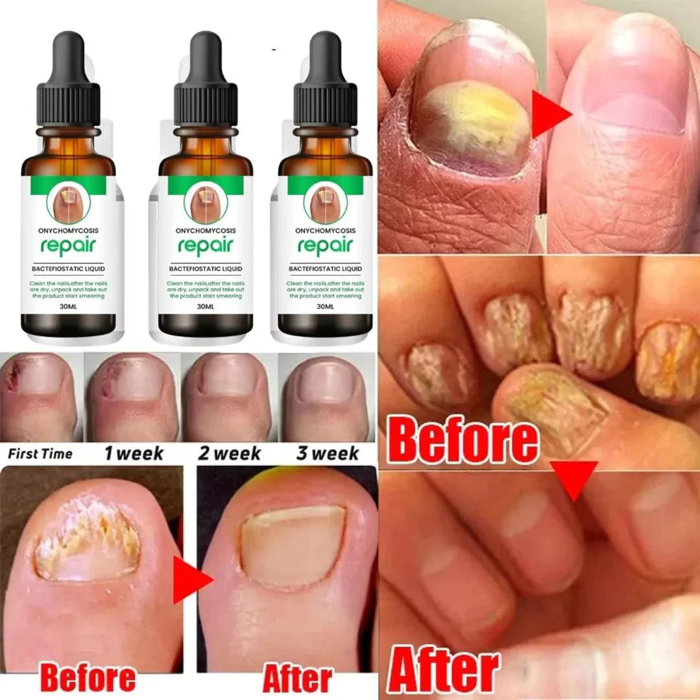Nail Care Serum