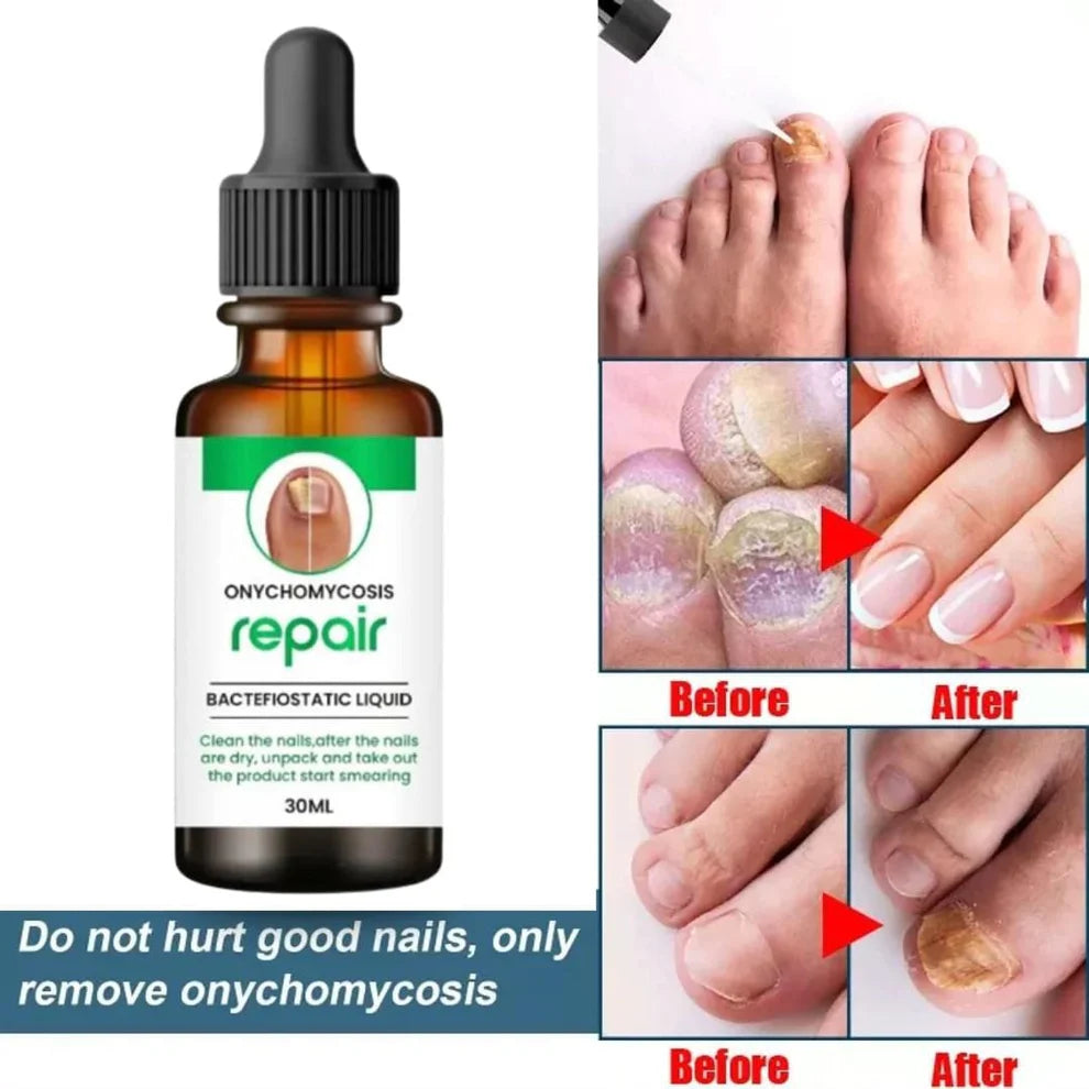 Nail Care Serum
